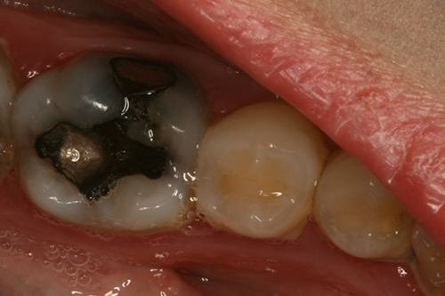 Crowns Before