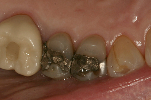 Crowns Before